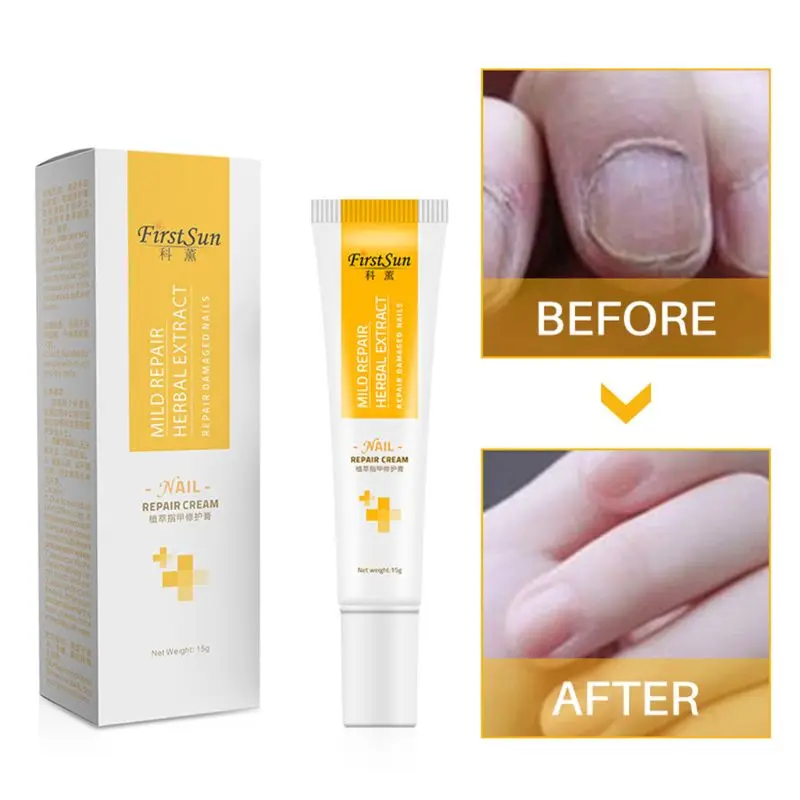 

Fingernail Treatments Cream Anti Nail Fungus Promote Nail Growth Strengthener