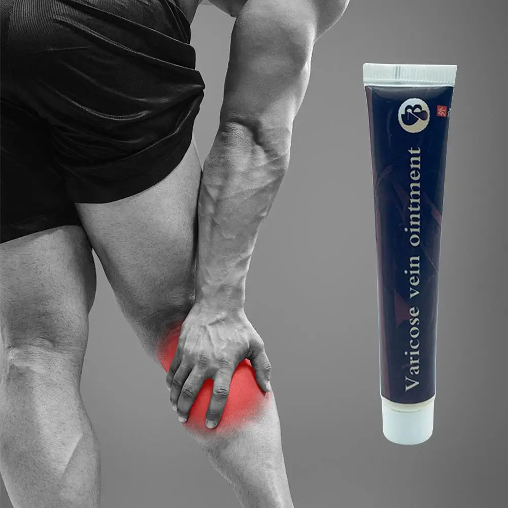 

Varicose Veins Treatment Cream Vasculitis Treatment Phlebitis Angiitis Inflammation Blood Vessel Effective Health Care Ointment