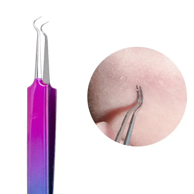 

1 Pc Useful Pimples Needle Acne Needle Acne Remover Piple Cleaning Remover Blackhead Needle Face Skin Care Tool (Hook Clamp)