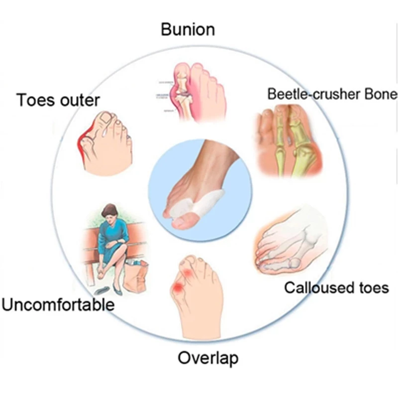 Silicone Toes Separator Bunion Bone Ectropion Adjuster Outer Appliance Hallux Valgus Corrector 2Pcs toe separators toe corrector toe spreader finger toe separator toe protectors
