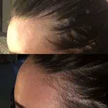 Cuidado del cabello para el crecimiento del cabello aceites esenciales esencia Original auténtico 100% pérdida de cabello líquido salud belleza suero denso para el crecimiento del cabello