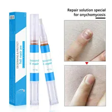 Горячая, ручка для ремонта грибка для ногтей, продукция для ухода за ногтями, антигрибковая ручка для ухода за ногтями из китайских трав