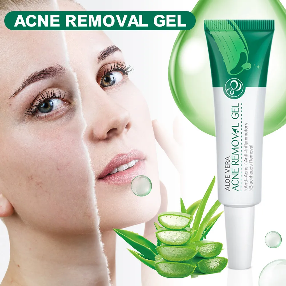 Efective Acne Removal Cream Oil Control Aloe Spots Treatment Pores