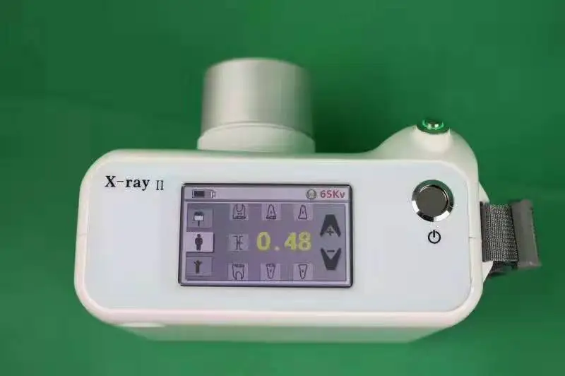 Ce Approved China Supply Medical Professional Portable Dental  X-ray CCD Camera