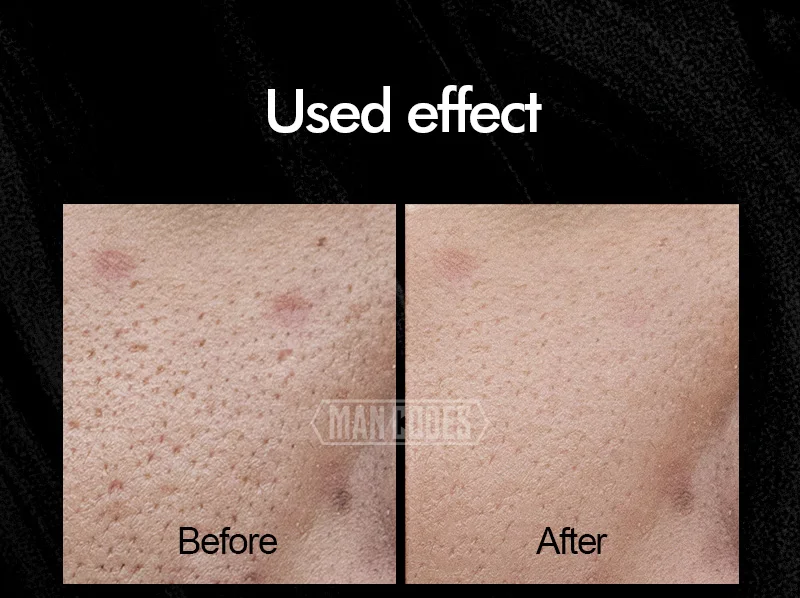 男士乳糖酸精华液详情-水印_09