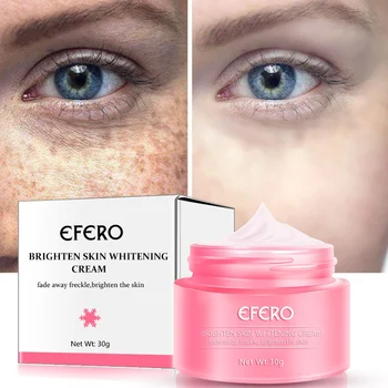 

30g Remove Freckles Cream Skin Whitening Cream Reduces Age Spots Fade Dark Spots Treatment Stain Face Cream Skin Care Product
