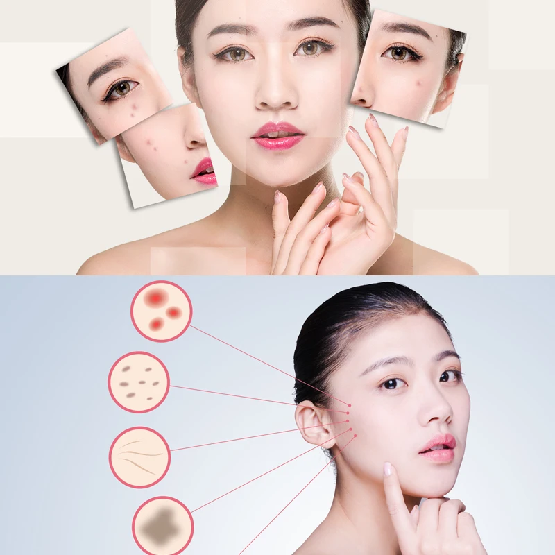  DARSONVAL 192 derma roller micro needles titanium microneedle mezoroller machine for for skin care 