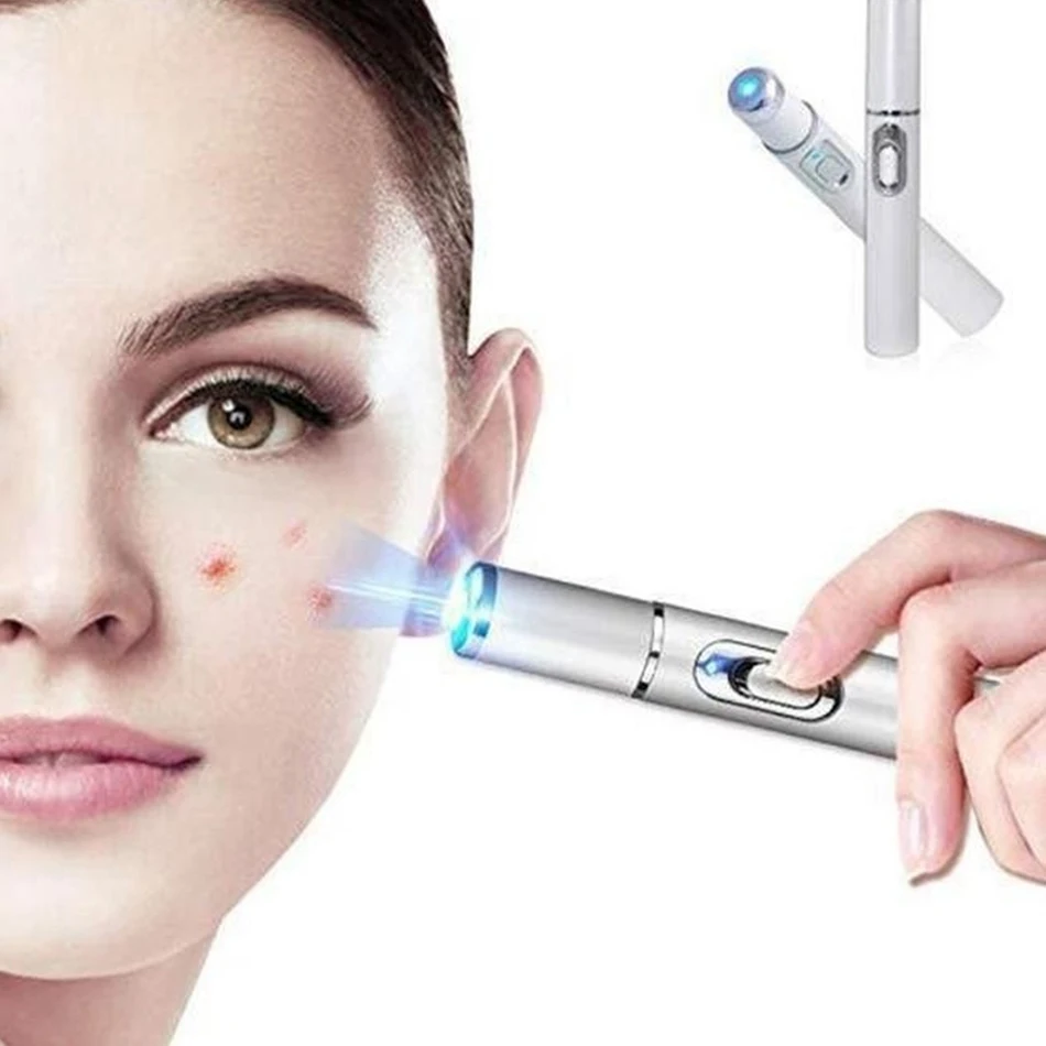 

Acne Laser Pen Portable Wrinkle Removal Machine Durable Soft Scar Remover Device Blue Light Therapy Pen Massage Relax Tools