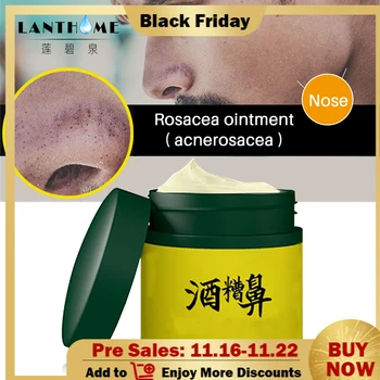 

Rosacea Cream Red Nose Ointment Remove Blackhead Acne Skin Care Herbal Anti Pimple and Mite Acne Redness Treatment Mild Treat