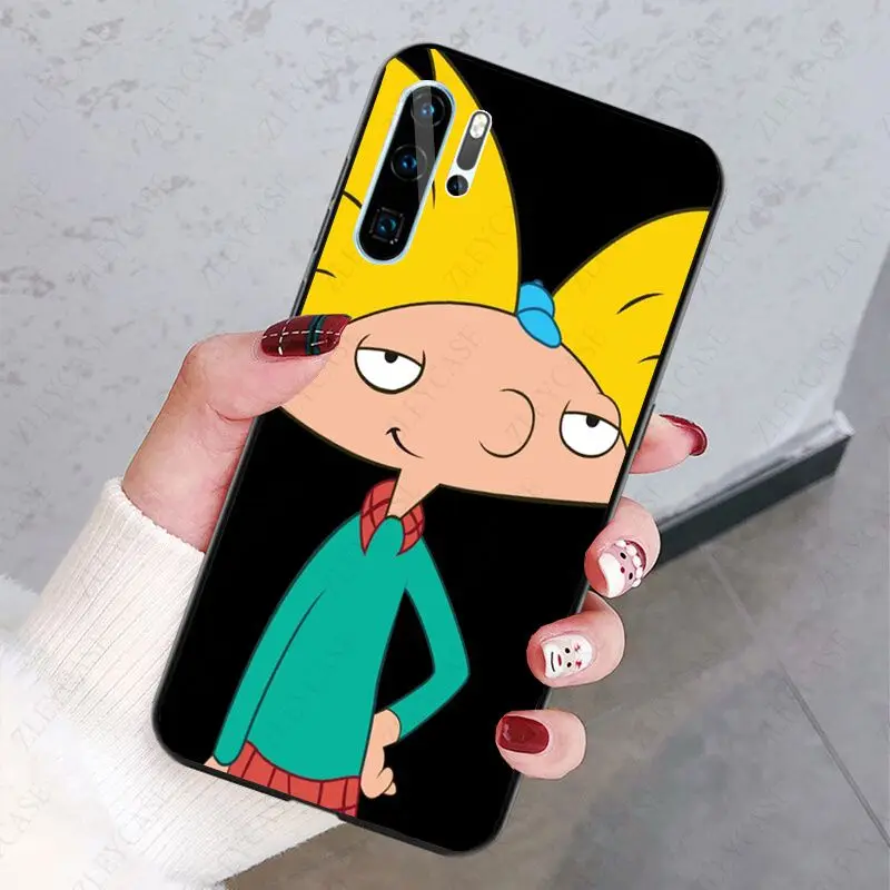 Hey Arnold