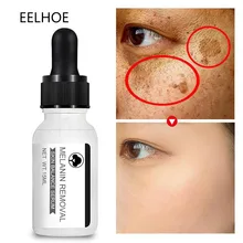 

Whitening Freckle Face Serum Remove Melasma Acne Spot Dark Spots Melanin Essence Moisturizer Repair Brighten Skin Care Cosmetics