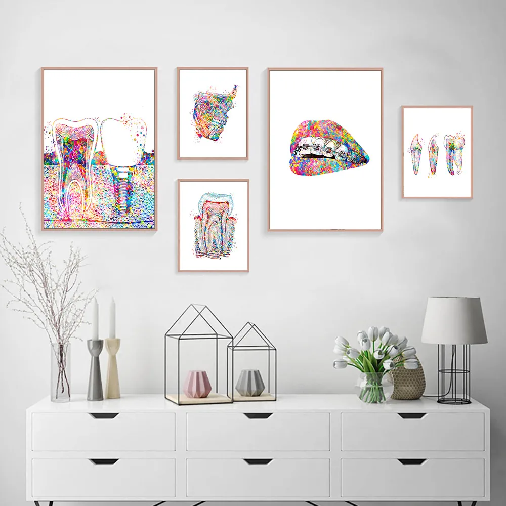 Tooth-Implant-Canvas-Wall-Painting-Dental-Art-Poster-Dentist-Anatomy-Prints-Medical-Wall-Art-Pictures-Hospital (3)