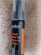 Sevich-espray de esencia para el crecimiento del cabello para hombres y mujeres, tratamiento para la pérdida del cabello, nutre las raíces, fácil de llevar, cuidado del cabello Germinal rápido, 30g