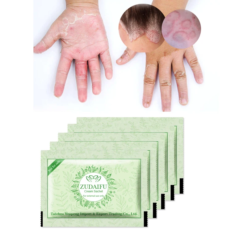 10 шт. дропшиппинг Zudaifu крем для лечения псориаза кожи крем для ухода за кожей