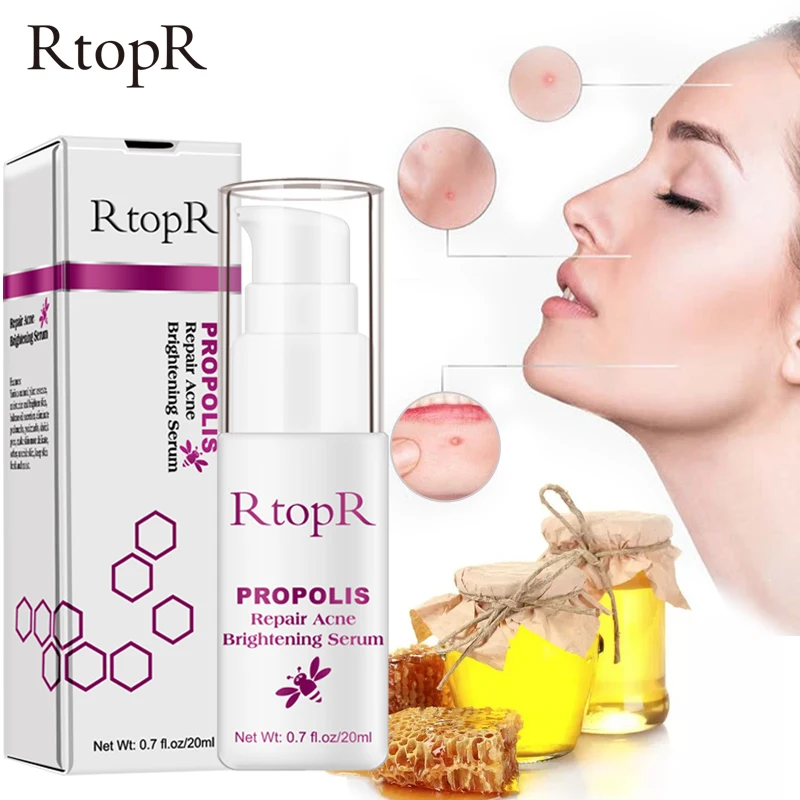 

RtopR Propolis Acne Face Serum Moisturizing Whitening Moisturizing Serum Removal Spot Acne Anti-Wrinkle Facial Essence Skin Care