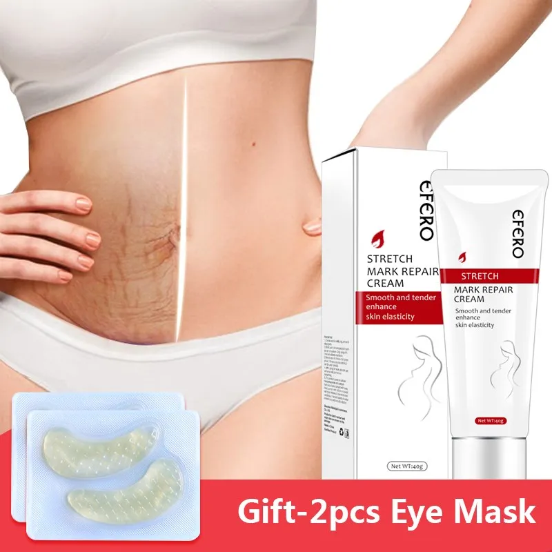 

Maternity Stretch Marks Cream Pregnancy Repair Scar Removal Cream Anti-wrinkle Mild Stretch Mark Cream Firming Skin Body Cream
