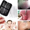 3-8Pcs Blackhead Acne Pimple Remover Needle Stainless Steel Popper Extractor Kit Tools Pore Deep Cleansing Women Beauty Cosmetic ► Photo 2/6