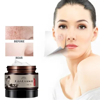 

30g Deep Repair Freckle Cream Anti Wrinkle Powerful Whitening Cream Fade Freckles Dark Spots Removal Skin Care Treatment TSLM1