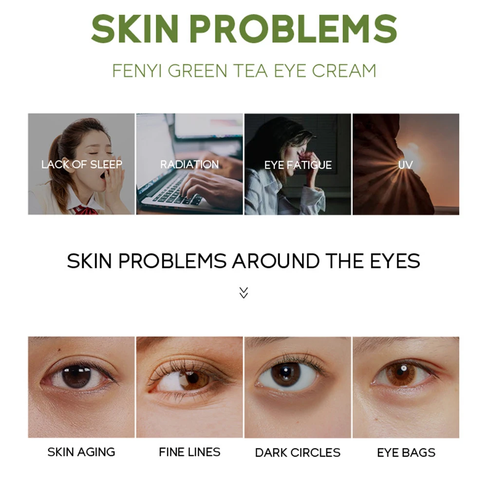 Share 146+ eye stye remedies tea bag esthdonghoadian