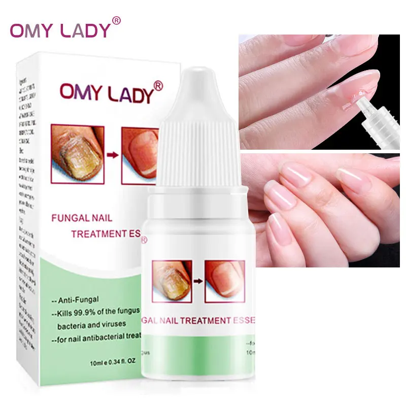 Сыворотка для восстановления ногтей от грибков OMY LADY Лечение грибка гель против