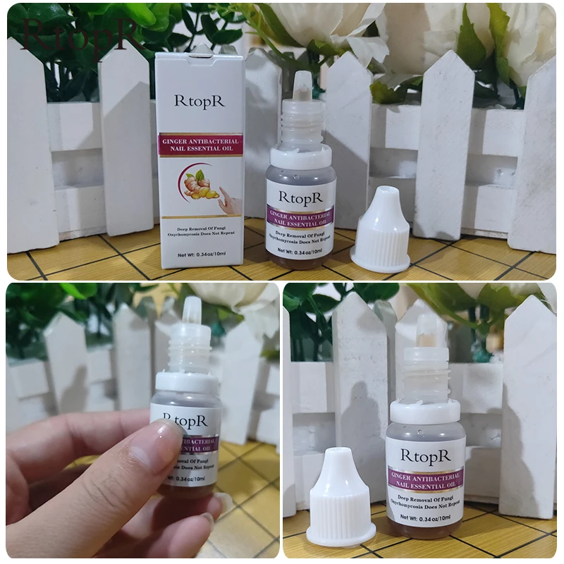 Имбирный Антибактериальный Уход за ногтями эфирное масло лечение онихомикоза