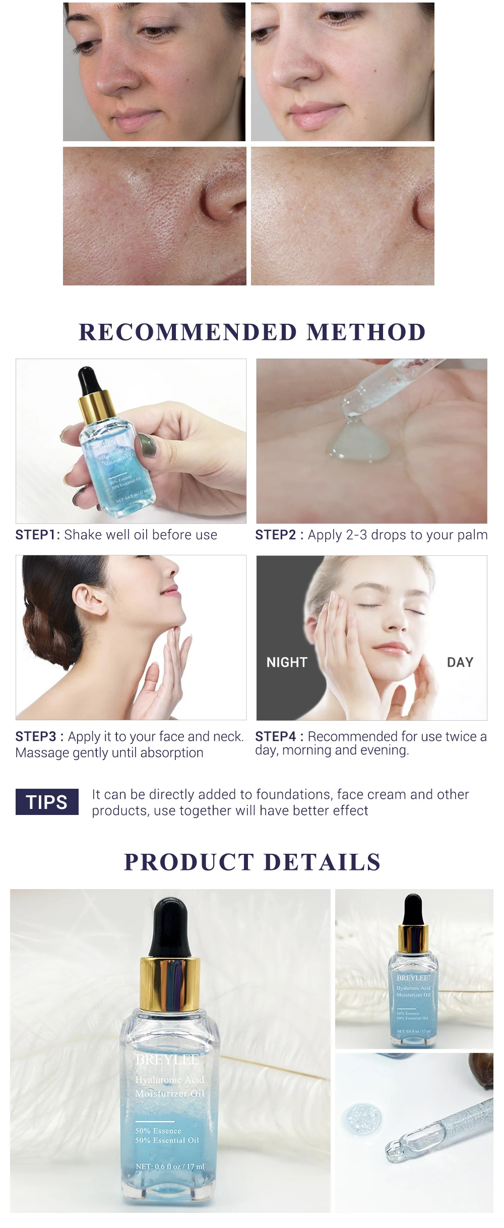 HTB1sRPIXInrK1RkHFrdq6xCoFXaz