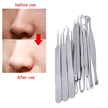 

9Pcs/Set Silver Acne Removal Tool Blackhead Comedone Pimple Spot Extractor Remover Needles Face Cleaner Makeup Beauty Tools