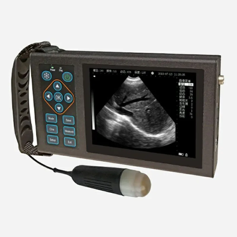 YUXINCAI Échographe sans Fil, Ultrasound Scanner Vétérinaire Portable, Échographie  Grossesse Testeur pour Truies Animale : : Commerce, Industrie et  Science