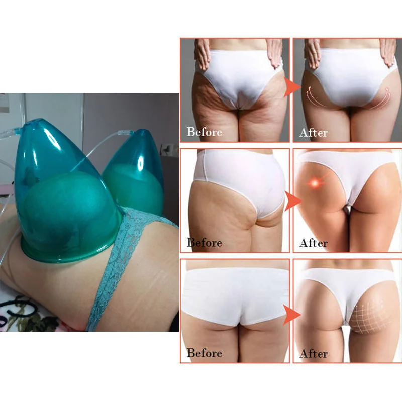 Vacuum Therapy Massage 24 Blue Cups Touch Screen Breast Enlargement Pump Butt Lifting Vacuum Therapy Body Cupping Guasha Massage