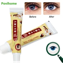 

1pcs Chinese Herbal Medicine Eye Care Cream For Relieve Eye Fatigue Improve Eyesight Effective Eye Care Health Products P1116