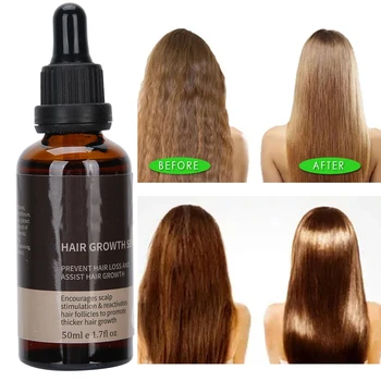 

1pcs 50ml Hair Growth Oil Anti Hair Loss Hair Growth Serum Hair Thinning Loss Repair Hair Follicles Promoting Blood Circulation