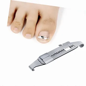 

Ingrown Toenail Corrector Toenail Correction Treatment Tool Nail Foot Care Tools Orthotic Nail Corrector Pedicure Tool