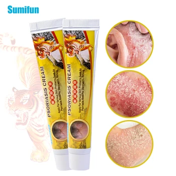 

SMF 1Pcs Psoriasis Bacteriostasis Ointment Eczema Dermatitis Anti-inflammatory Pruritus Antipruritic Eczematoid Cream 1Pcs
