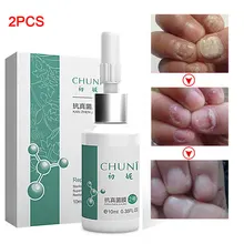 20 мл Relustering Harden пилинг противогрибковый портативный Leuconychia ускорение роста клей для ремонтных работ восстановление кольчатого червя внешнего использования