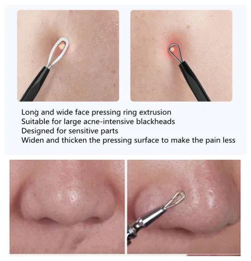 Value 4pcs Set Blackhead Remover Face Care Pimple Blackhead Remover Tool Spoon Facial Beauty Woman Skincare Makeup Tool Kit