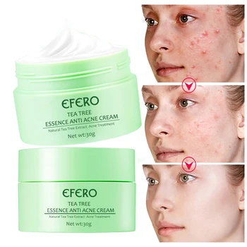 

Tea Tree Anti-Acne Face Cream Oil Control Shrink Pores Acne 30g Cream Nourish Whitening Acne Scar Remove Skin Care