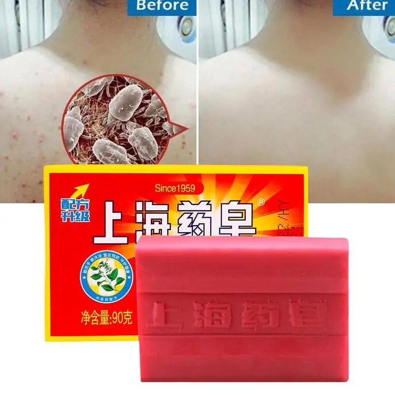 90g Red China Medicated Soap Conditions Acne Psoriasis Seborrhea Eczema Anti Fungus Bath Healthy
