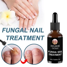 

10/20/30/50ML Nail Fungus Repair Liquid Repair and Remove Dead Skin on Onychomycosis Remove Bacteria Inhibit Bacteria