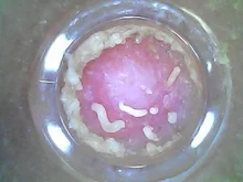 Limpiador de poros al vacío para eliminar espinillas, eliminador de acné, calefacción eléctrica, limpieza profunda de nariz, cámara de microscopio WIFI