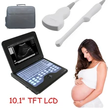 

CONTEC CMS600P2 Portable Ultrasound Scanner Laptop Machine Ultrasonic Systems 6.5 MHz Endo-vaginal Probe FDA And CE