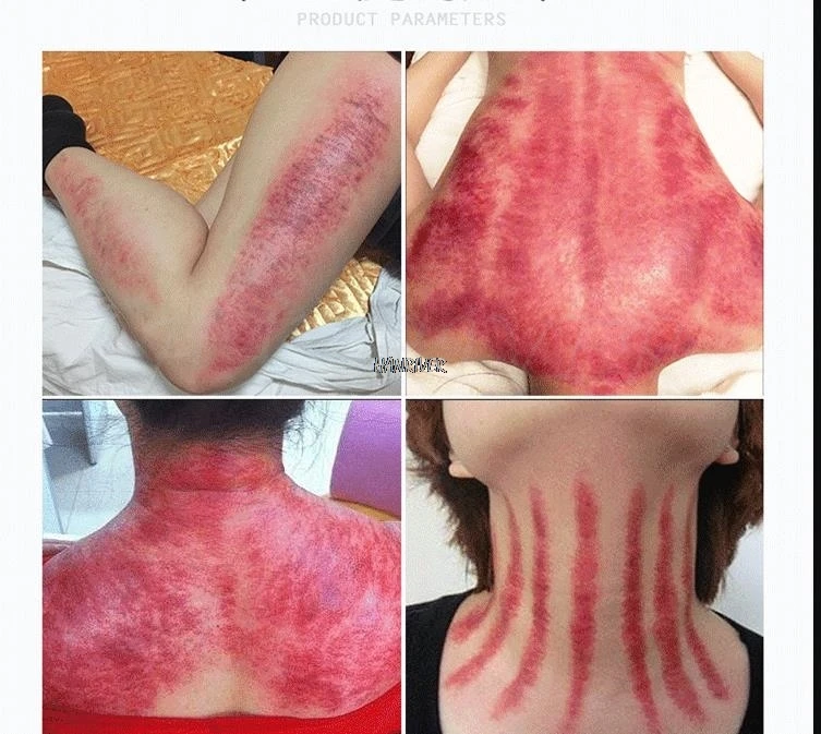 36020181014155008153