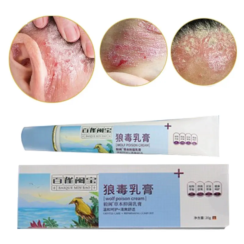 Eczema Cream Therapy Psoriasis Cream Itch Relief Dermatitis Rosacea