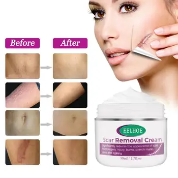 

Repair Scar Cream Remove Strech Mark Scald Caesarean Bump Surgery Scar Smooth Skin Brightening Face Cream Acne Treatment TSLM2