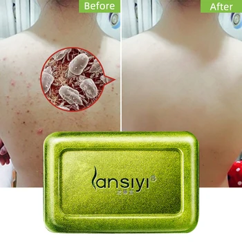 

Wash Face Soap Facial Anti Mites Sulphur Soap Body Cleansing Soap Shower skin care Accessory new