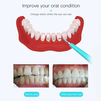 

Electric Dental Calculus Remover Tooth Stains Tartar Scraper 2 Cleaning Heads 3 Cleaning Mode with LED Light Teeth Whitening