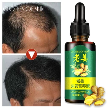

Ginger Hair Growth Serum Liquid 7 Days Fast Growth Essence Anti Hair Loss Repair Damaged Hair, Preventing Hair Lose 30ml