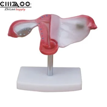 

Medical Education Anatomical Uterus Model