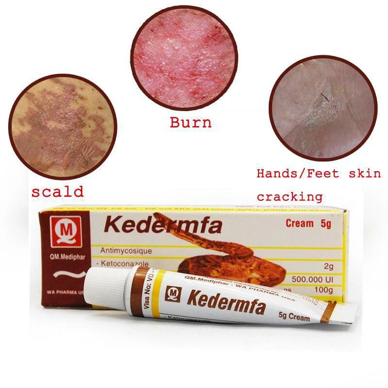 Crema de manos para el cuidado de la piel, aceite de serpiente Kedermfa de Vietnam, 5g, crema para quemar piel, craqueo, Eczema, Reparación de la piel, gran oferta