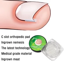 

New 10pcs/set Ingrown Nail Pad Ortho Nail Filling Nail Groove Pad Ingrown Nail Corrector Ingrown Nail Artifact
