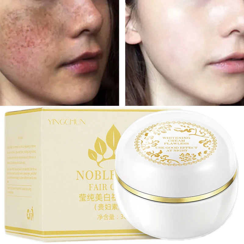 

Skin Whitening Face Cream Skin Tightening Pores Brighten Tone Fade Fine Lines Anti-Aging Nourish Improve Skin Elasticity 30g